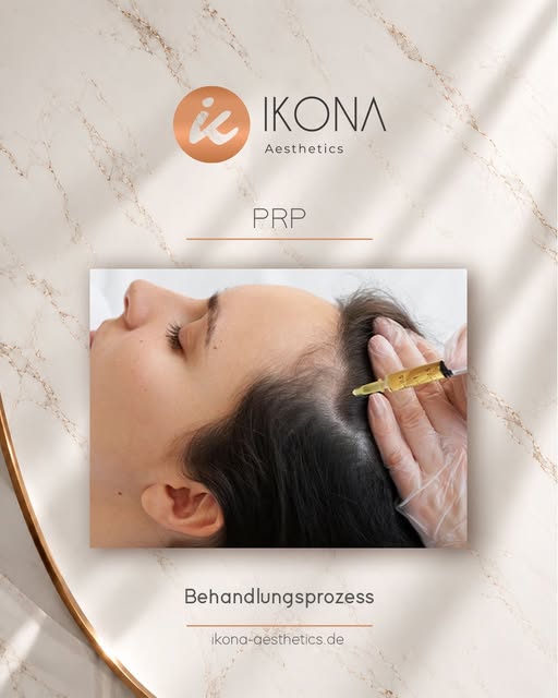PRP (Platelet-Rich Plasma) ist eine Behandlung, bei der plättchenreiches Plasma aus dem eigenen Blut