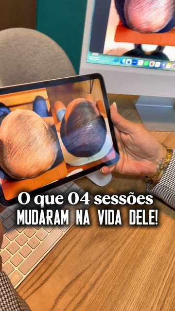 O cabelo pode mudar a vida de uma pessoa, assim como mudou a desse paciente. 

Não fique aí parado, 