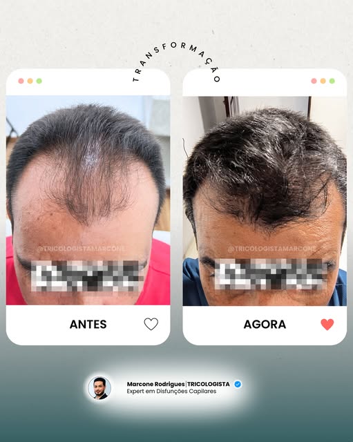Constância e comprometimento! É isso que o paciente precisa ter para alcançarmos resultados satisfat