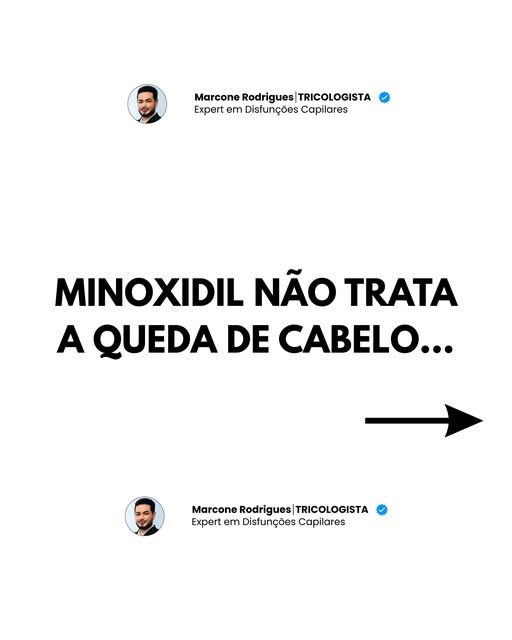 Diversos fatores podem ocasionar a Queda de Cabelo e apenas fazer o uso do Minoxidil pode não ser a 