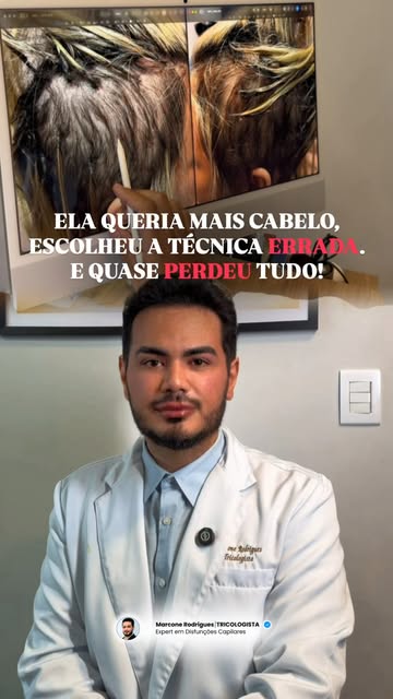 Ela queria mais volume, mais comprimento, mais cabelo.
Mas, com o tempo, começou a perder justamente