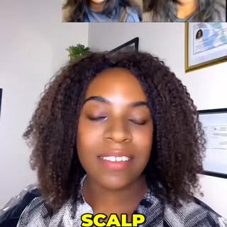 Scalp micropigmentation: the specialized tattoo creating natural hair follicle illusion. Fixes reced