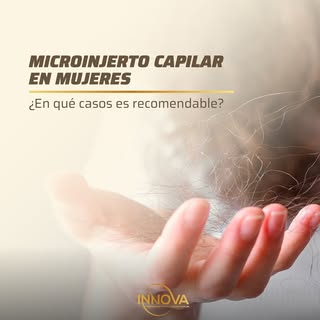 Cada vez más mujeres deciden dar el paso y recuperar la densidad de su cabello con un microinjerto c