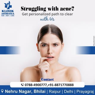 Get the permanent solution to your acne and flaunt your clear skin 

Book your appointment today: 📞