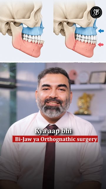 Bi-jaw surgery isn’t simply about changing the way the face looks, it can involve bite, jaw alignmen