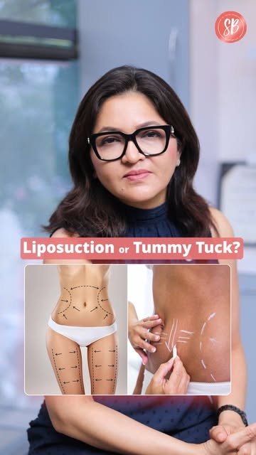 This or That? But make it Plastic Surgeon edition. 👀🩺

From surgical choices to aesthetic preferen