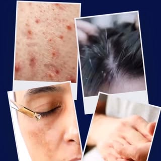 Skin conditions you should never treat at home 🚫

Do you know someone who self treats them self ? T