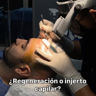 ¿Injerto capilar o regeneración capilar?

En este video te explico sus diferencias y quién es candid