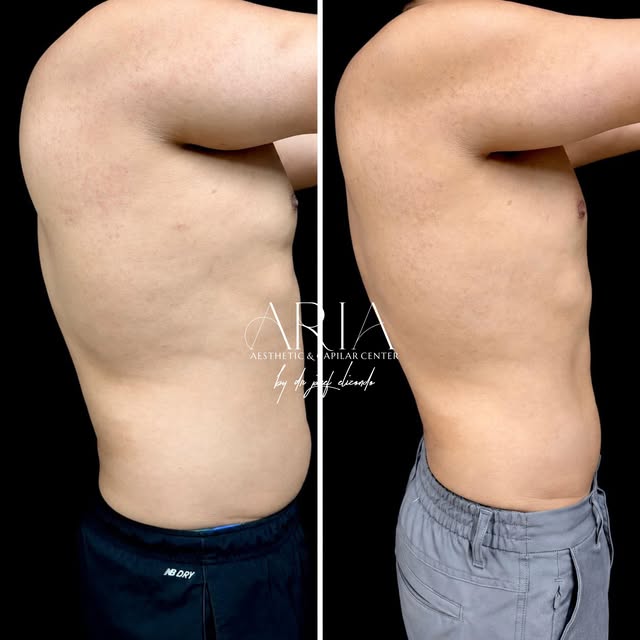−13 KG | Un proceso, no un atajo.

Disciplina + seguimiento nutricional + acompañamiento médico + an