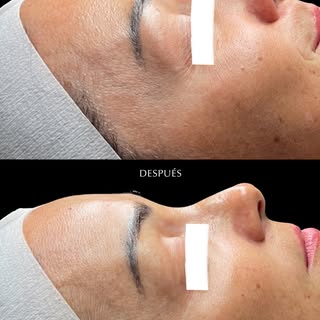 ☀️ Después del verano, tu piel también necesita recuperarse.

En ARIA Center diseñamos tratamientos 