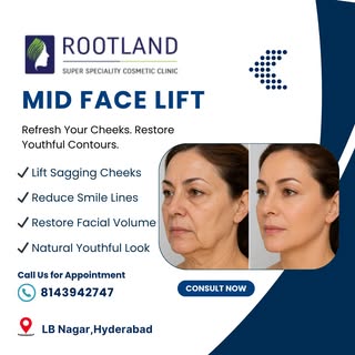 Turn back time with a Mid Face Lift ✨
Restore youthful contours and regain your natural confidence.
