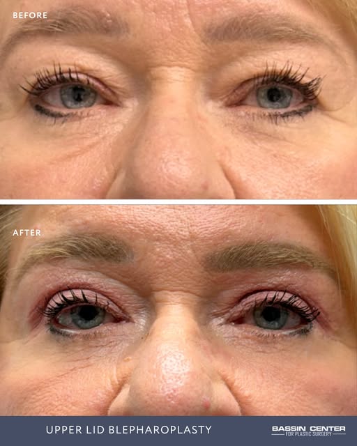 Sometimes, a little change can bring back a whole lot of confidence. 🤍

Your eyes tell your story. 