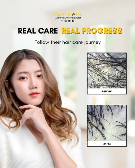 Real care takes time. Real progress comes from consistency. 🌿
From understanding the scalp conditio