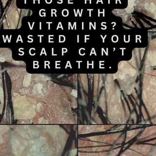 Your hair growth oil, vitamins, and shampoos can’t do their job if your scalp is full of buildup. Sw