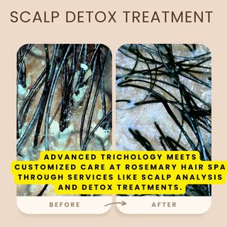 Scalp detoxing supports stronger, healthier hair growth.  Book now!  #rosemaryhairspa #headspa #scal