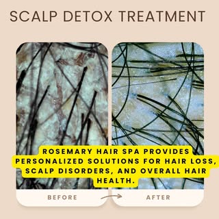 Everyday habits bring bacteria to the scalp. A detox helps reset it.  Book your Scalp Detox now!
#ro