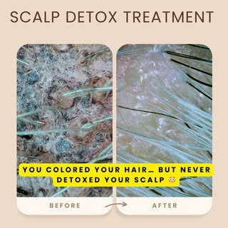 ✨ BEFORE & AFTER SCALP DETOX ✨

This is what’s left behind after hair coloring…Chemical residue, pro