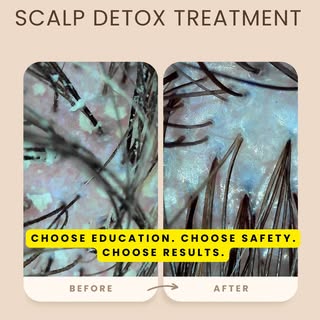 POV: Not every “Head Spa” is a real Head Spa 

Anyone can shampoo hair. Not everyone is trained in s