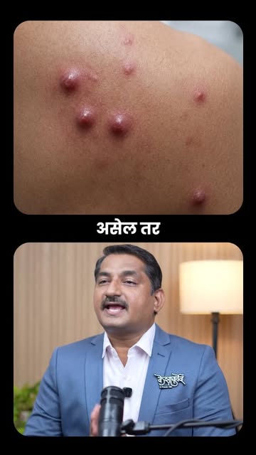 पाठीवर आणि खांद्यावर सतत पिंपल्स येतात? आधी पोट तपासा! 🩹🌿

back acne constipation, gut health skin