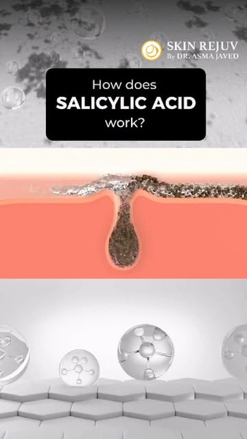 Your skincare ingredients aren't random; they each have a job. 
Salicylic Acid clears pores, Retinol