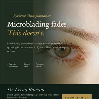 Tired of drawing your eyebrows every day? 🤨

An eyebrow transplant moves individual hair follicles 