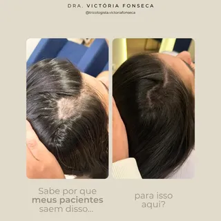 Sabe por que meus pacientes chegam nesse resultado?

Não é porque encontraram um shampoo milagroso. 
