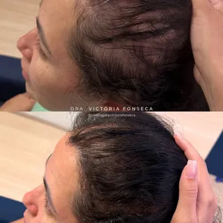 Mais um resultado que reforça uma verdade: quando o tratamento é individualizado, os resultados apar