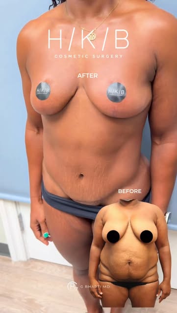 🔥✨ MORE THAN A TRANSFORMATION… A COMPLETE REINVENTION. ✨🔥

Some before & afters stop you in your t