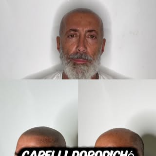 La vostra felicità la mia gioia più grande!!
Grazie❤️❤️❤️

Operatore:Luigi Ruffoni🔝🔝 

Attraverso 