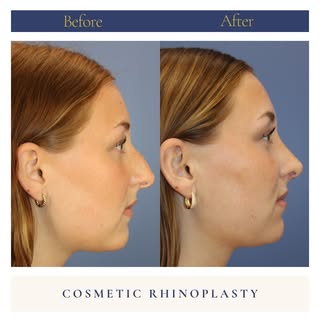 💖 Feminine, Natural, Confident! 💖

This beautiful young lady came to Dr. Caceres with the goal of 