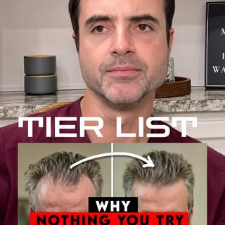 SAVE THIS VIDEO (for later)- Ranking the most popular hair loss treatments from S to F tier based on