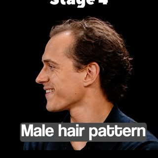 Sorry @tomholland2013 🕸️🕺

#hairloss
