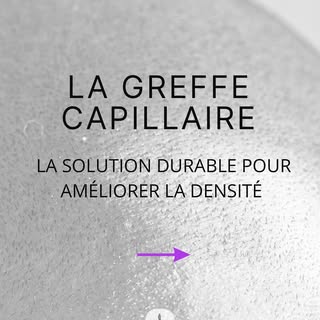 🧔🏻La greffe capillaire permet de restaurer votre chevelure  en utilisant vos follicules pileux ins