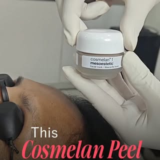 Transform Your Skin with the Power of Cosmelan Peel
Experience a complete skin transformation with t