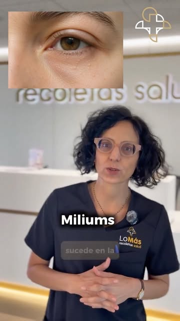 ✨ ¿Esas pequeñas bolitas blancas son granos? Probablemente no.

Los milium son pequeños quistes de q