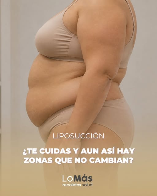 Hay zonas que, por mucho que te cuides, parecen no cambiar.

La liposucción está diseñada para elimi