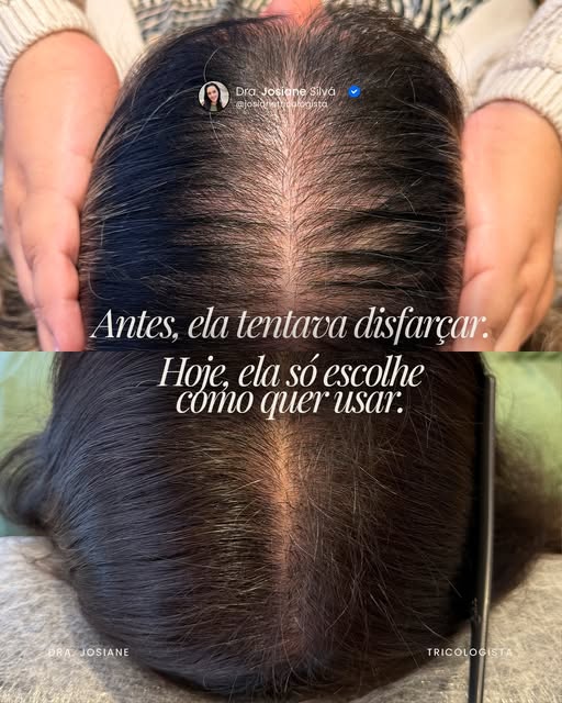 Tem resultado que aparece na foto e tem resultado que aparece na rotina.

Nesse caso, o tratamento f