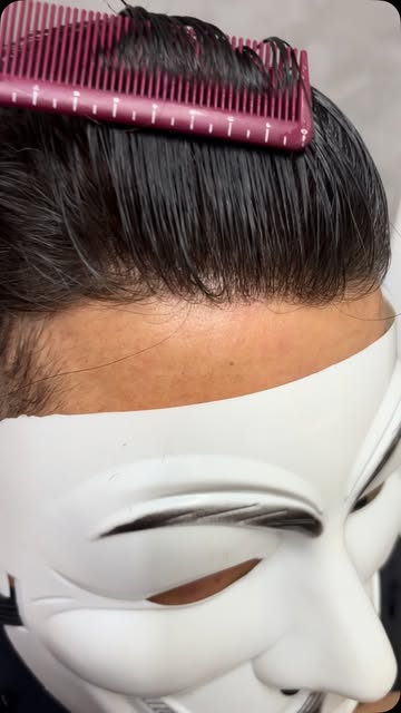 Essa é a naturalidade que você procura?
Trabalhamos com todos os tipos de prótese capilar e nosso ob