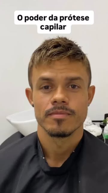 A prótese capilar te faz recuperar sua autoestima e jovialidade. 
Quer ter um resultado como esse na