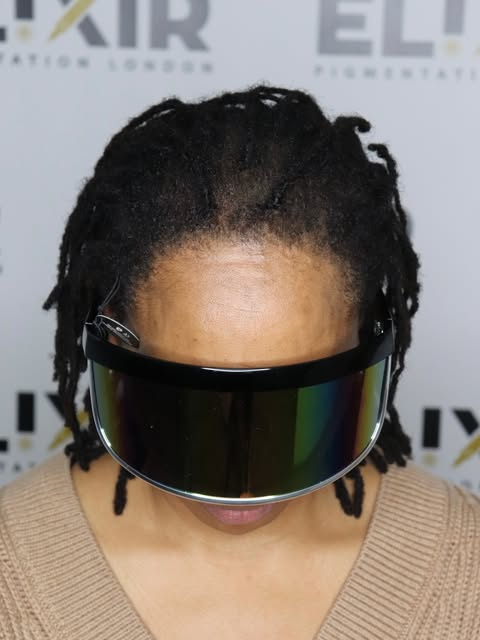 Density enhancement case for an Afro-Caribbean female client with dreadlocks. 🔥

Working around the