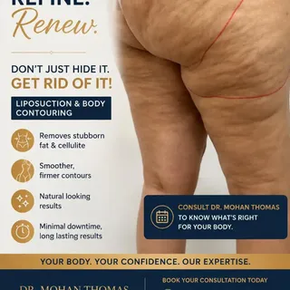 ✨ Sculpt Your Legs with Thigh Liposuction & Body Contouring ✨

.
.
.
.
.
.
.

Are you struggling wit