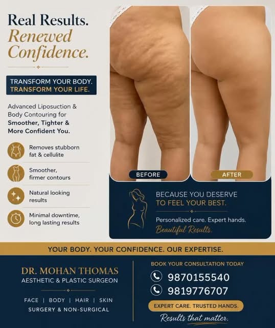 #✨ Sculpt Your Legs with Thigh Liposuction & Body Contouring ✨

Are you struggling with stubborn fat