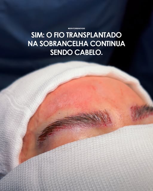 Os fios utilizados continuam carregando características da região de origem e, por isso, podem exigi