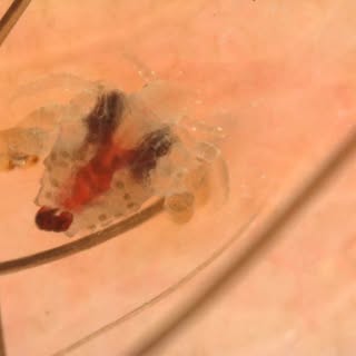 Body mite 😮