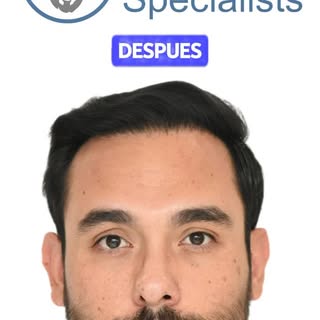 💥 Los resultados no mienten. Compruébalo tú mismo.
Este paciente decidió dar el paso y hoy se sient