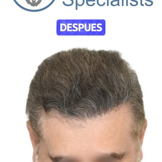 🌱 Ver crecer tu cabello es ver crecer tu seguridad.
Swipe 👉 y descubre el antes y después de este 