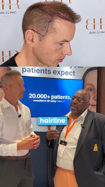 "You designed my hairline 10 years ago, how did it go?" answered by @dr.christianbisanga from @bisan