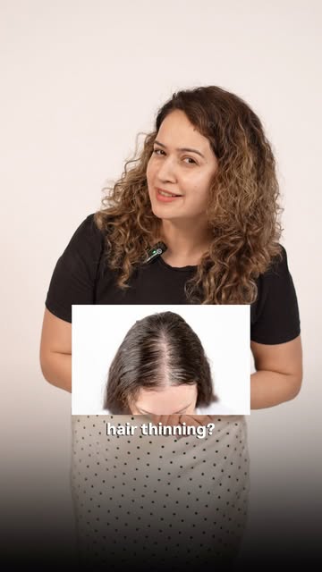 Hair thinning? Vote for since you have had it and ask me your questions right away 👇