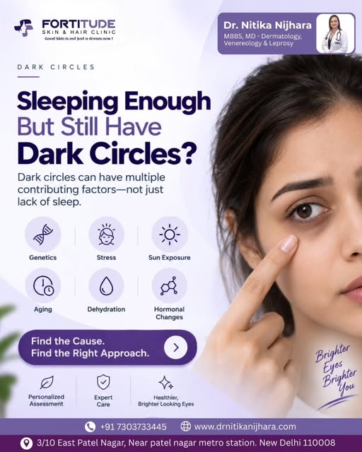 Sleeping enough but still struggling with dark circles? 👀

Dark circles are not always caused by a 