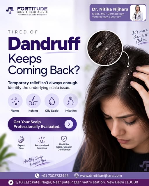 Persistent dandruff can be more than just a cosmetic concern—it may indicate an underlying scalp con